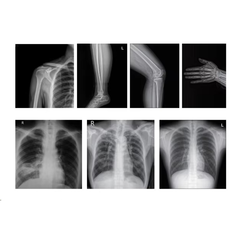 Máquina de Rayos X para Imagen - Photography X Ray reseña y precio